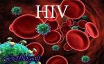 ویروس HIV با زیاد کردن خطر زوال عقل مرتبط است